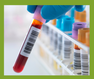 Image of vials of blood