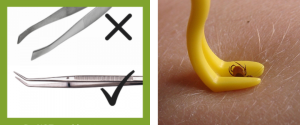 tick remover tool