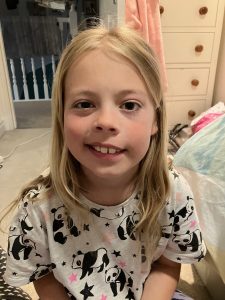 Little girl with facial palsy due to Lyme disease.